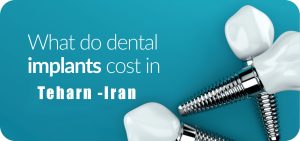 Dental implant cost & timeline in Tehran – Iran